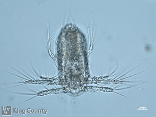 Photo of Copepoda: larval stages